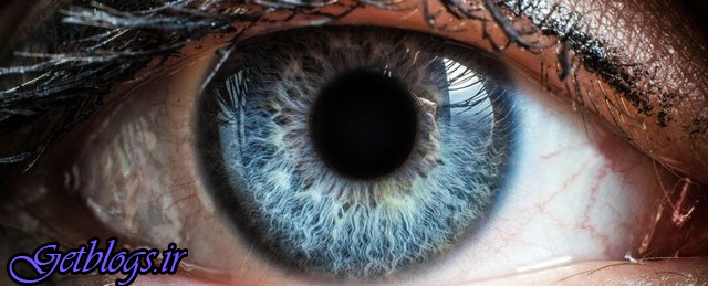 امیدی جهت درمان آسیب‌های قرنیه , قطره‌ چشمی غشای آمنیوتیک
